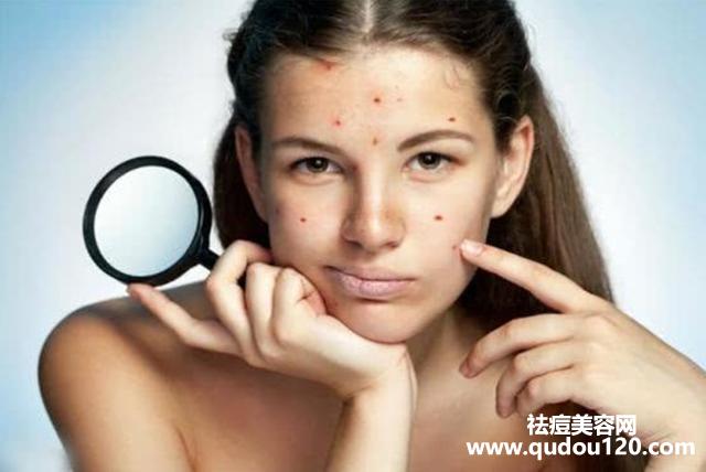 痘痘要在医院治疗还是美容院治疗好（脸上长痘痘去医院还是美容院）