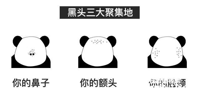 黑头粉刺怎么样才能彻底根除（如何快速消除黑头粉刺）