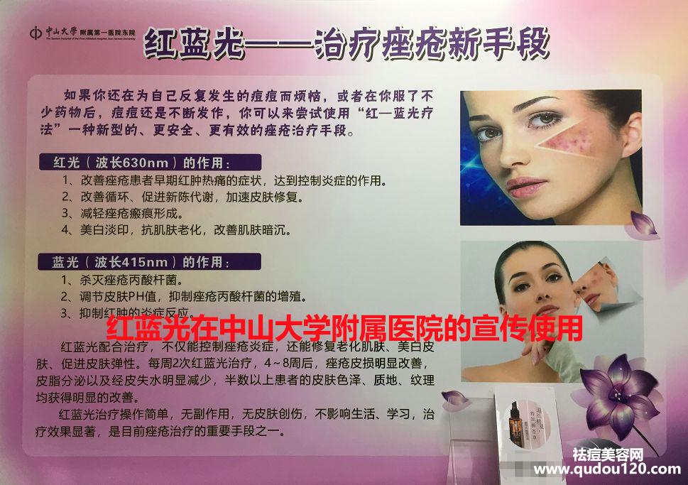 红蓝光祛痘到底有没有效果（红蓝光做几次才有效果）