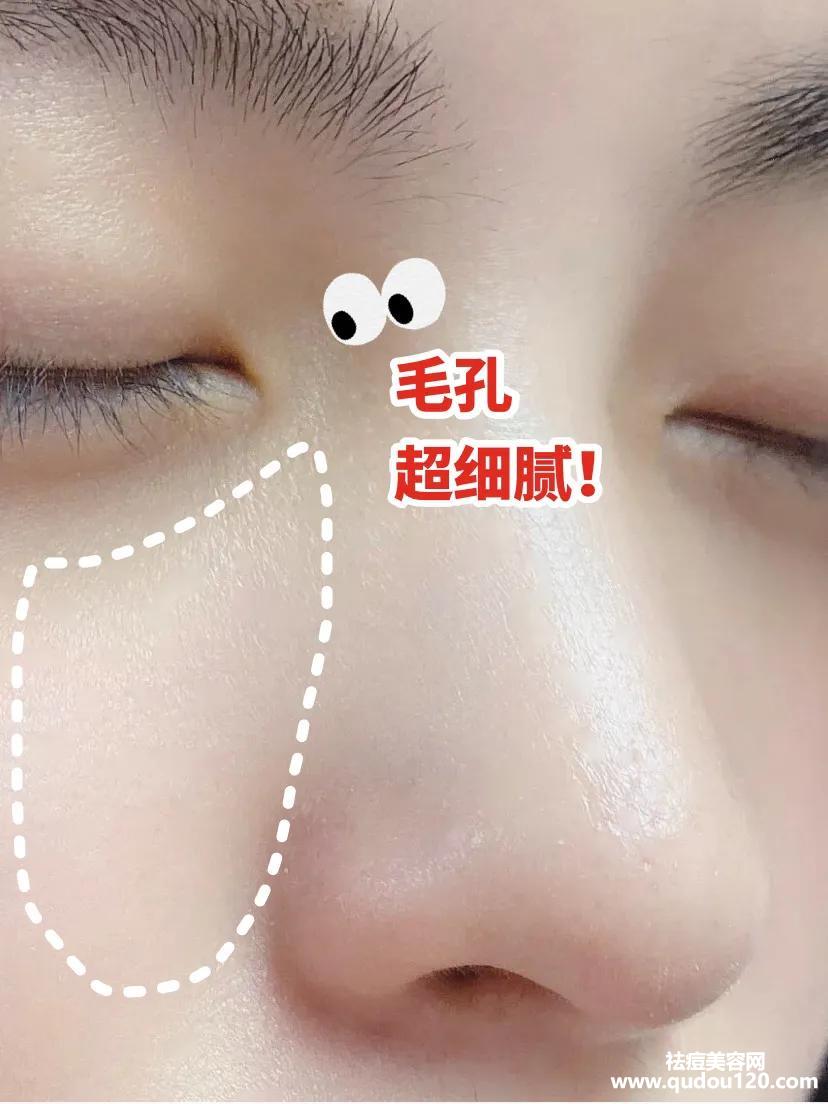 黑头粉刺怎么样才能彻底根除（如何快速消除黑头粉刺）