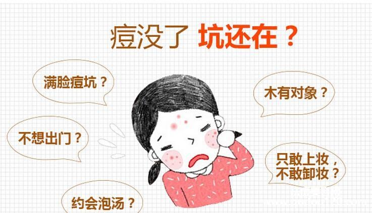 激光祛痘印多久见效（激光祛痘坑痘印多长时间能好）