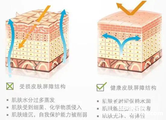 皮肤角质层薄怎么才能增厚（怎么把皮肤角质层养厚）
