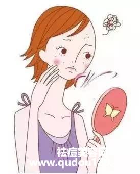 激光祛痘一般疗程多久（祛痘需要几个疗程）