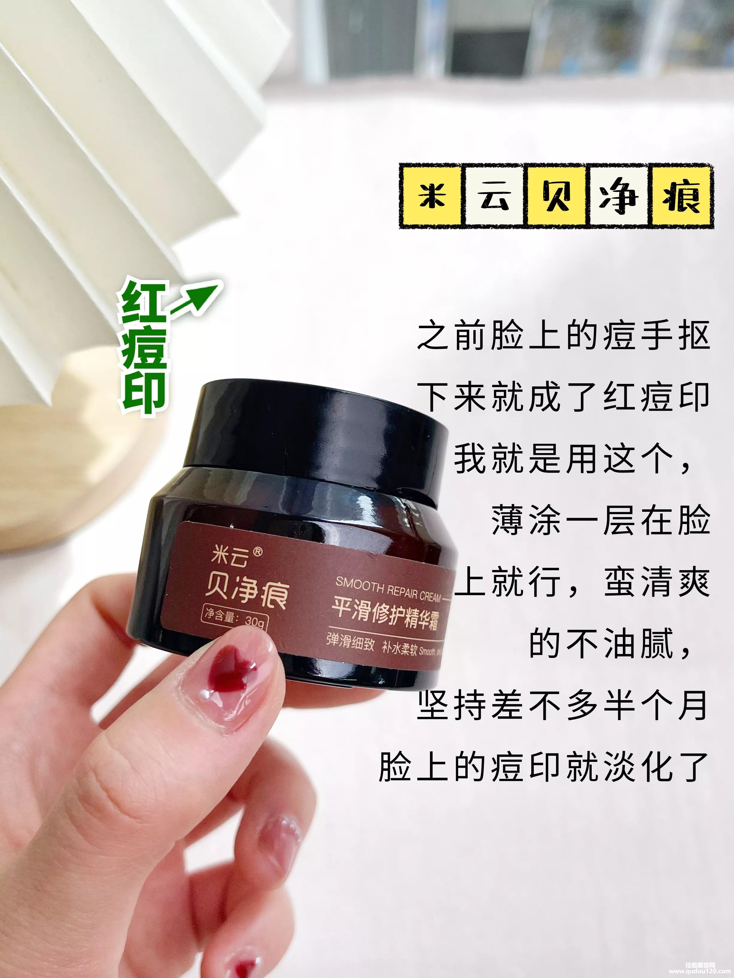 学生祛痘产品哪个好（适合中学生的祛痘产品）