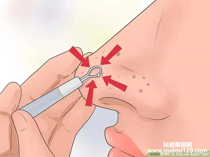 长期痘痘针清的危害（针清能彻底治好痘痘吗）