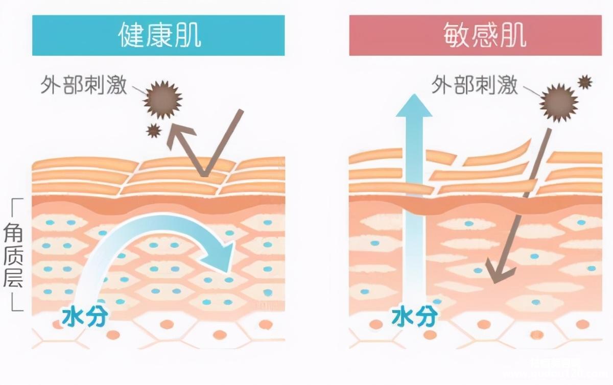 皮肤角质层薄怎么修复（修复脸上角质层薄小妙招）