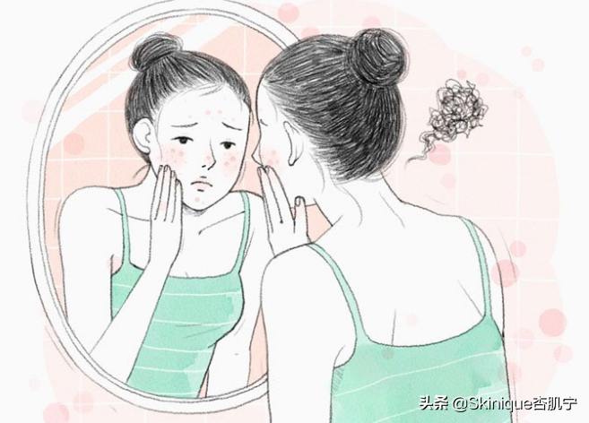 痘痘应该如何预防（预防痘痘的方法是什么）